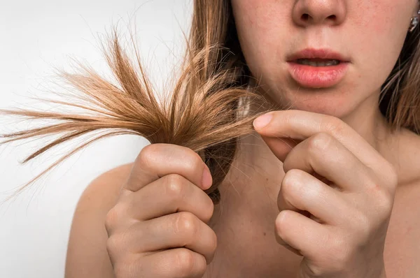 Causas e sintomas da queda de cabelo