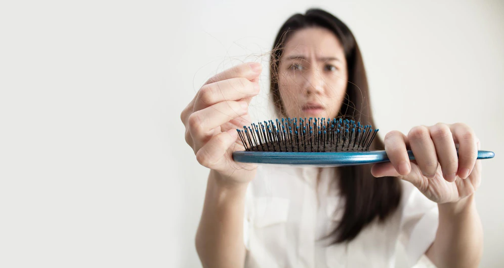 Como trata a queda de cabelo com Implante Capilar em BH?