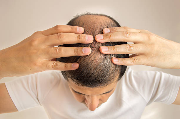 Como o tratamento pode ser mais acessível para quem deseja recuperar o cabelo